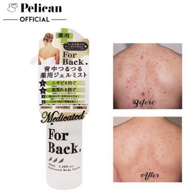 Xịt Lưng Pelican For Back Medicated Body Lotion (100ml)